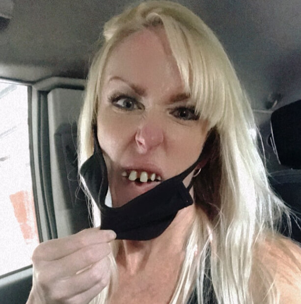 Billy Bob Teeth